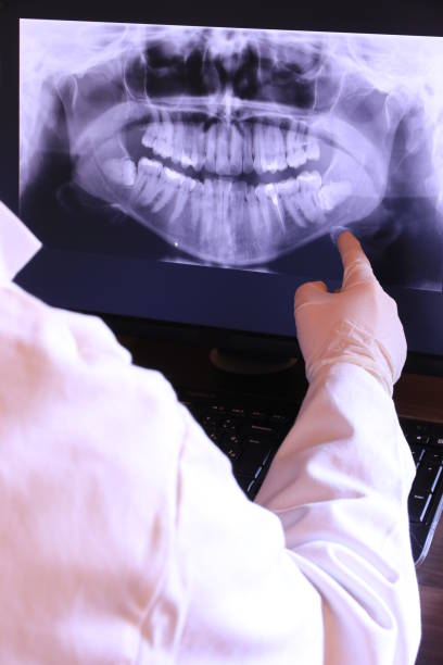 Best Emergency Root Canal Treatment in Hancock, MI