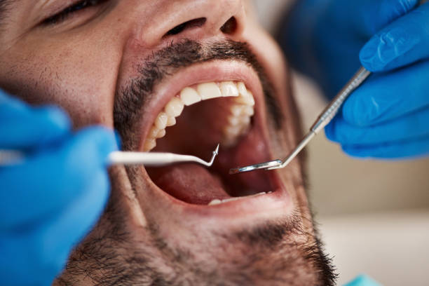 Best Emergency Dental Care for Abscessed Tooth in Hancock, MI